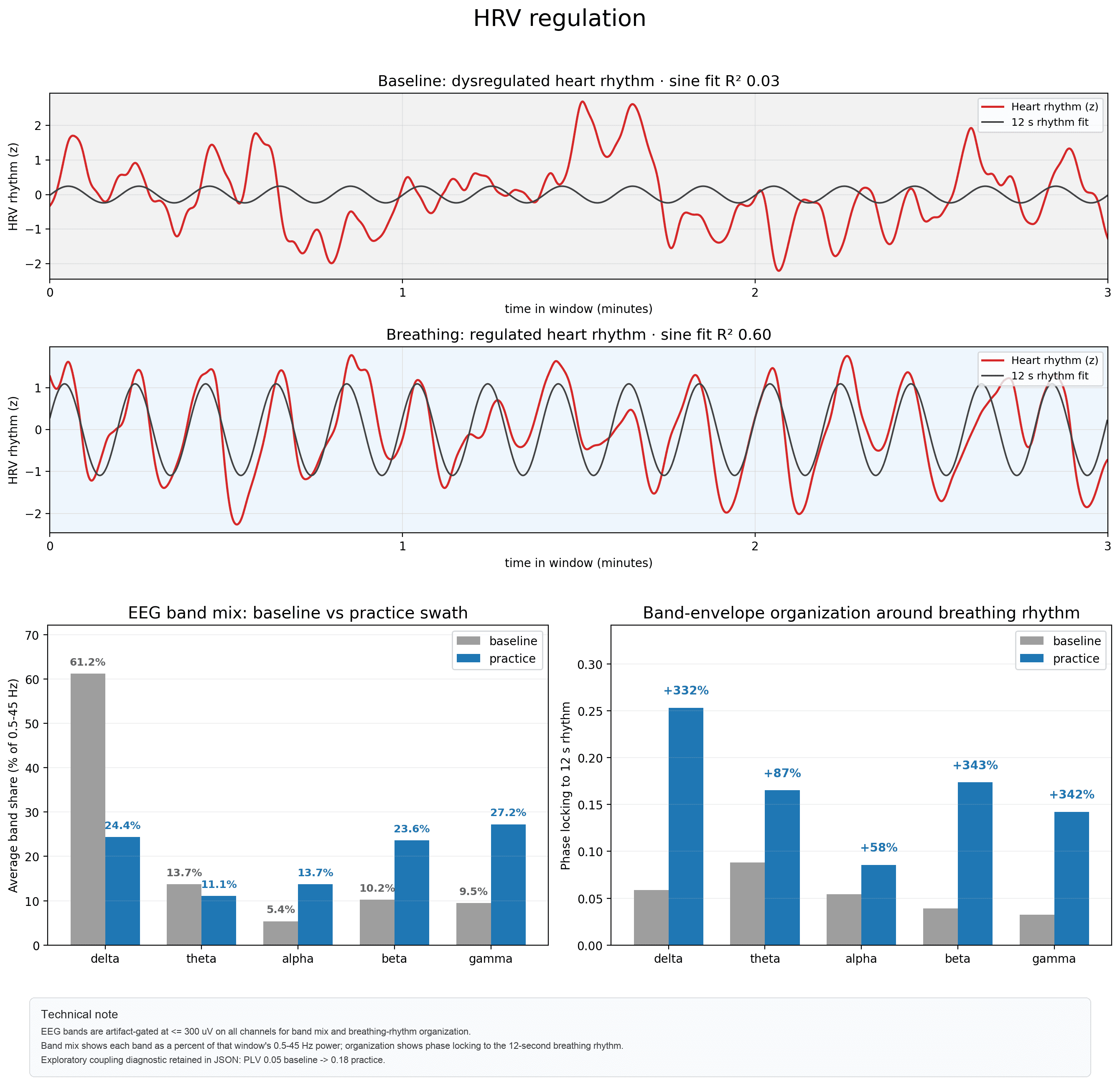 HRV regulation report: baseline dysregulated heart rhythm versus regulated heart rhythm during breathing, with EEG band shift and band-envelope organization